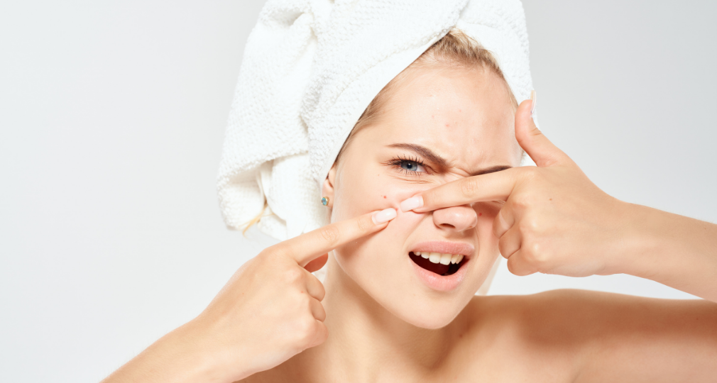 Boutons à 30 ans : pourquoi votre peau fait sa crise d’ado