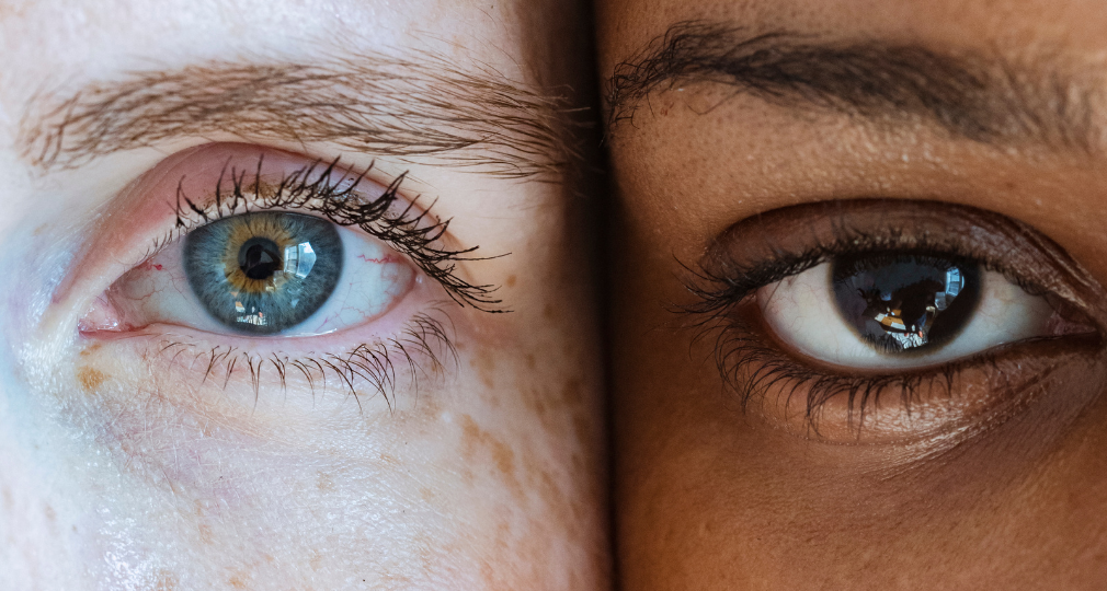 Mélasma : ne laissez pas vos hormones dicter la couleur de votre teint