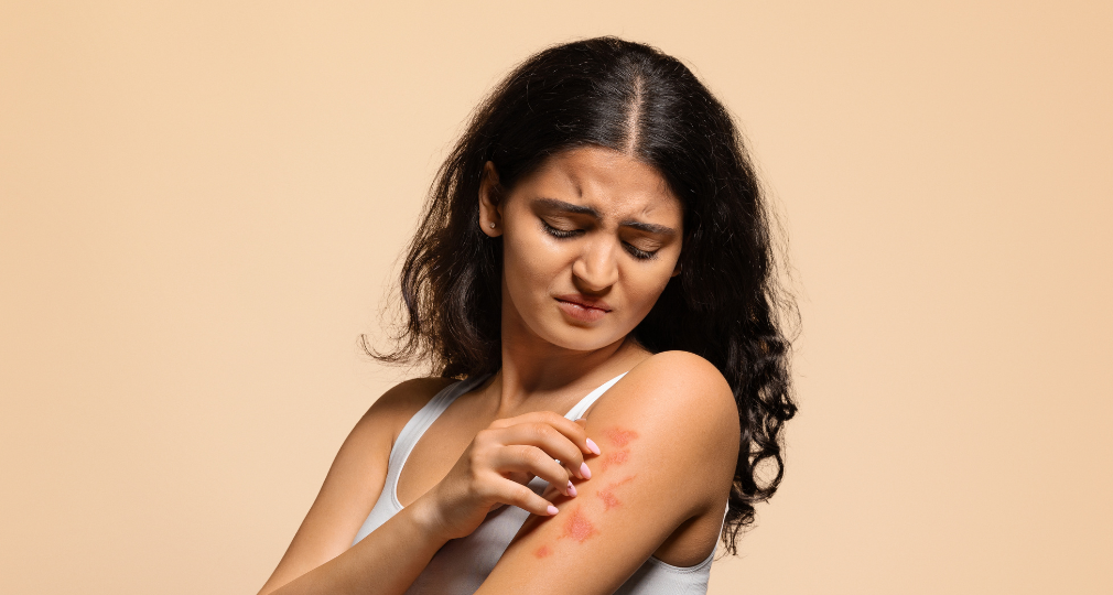 Psoriasis : et si vous appreniez enfin à aimer votre peau ?